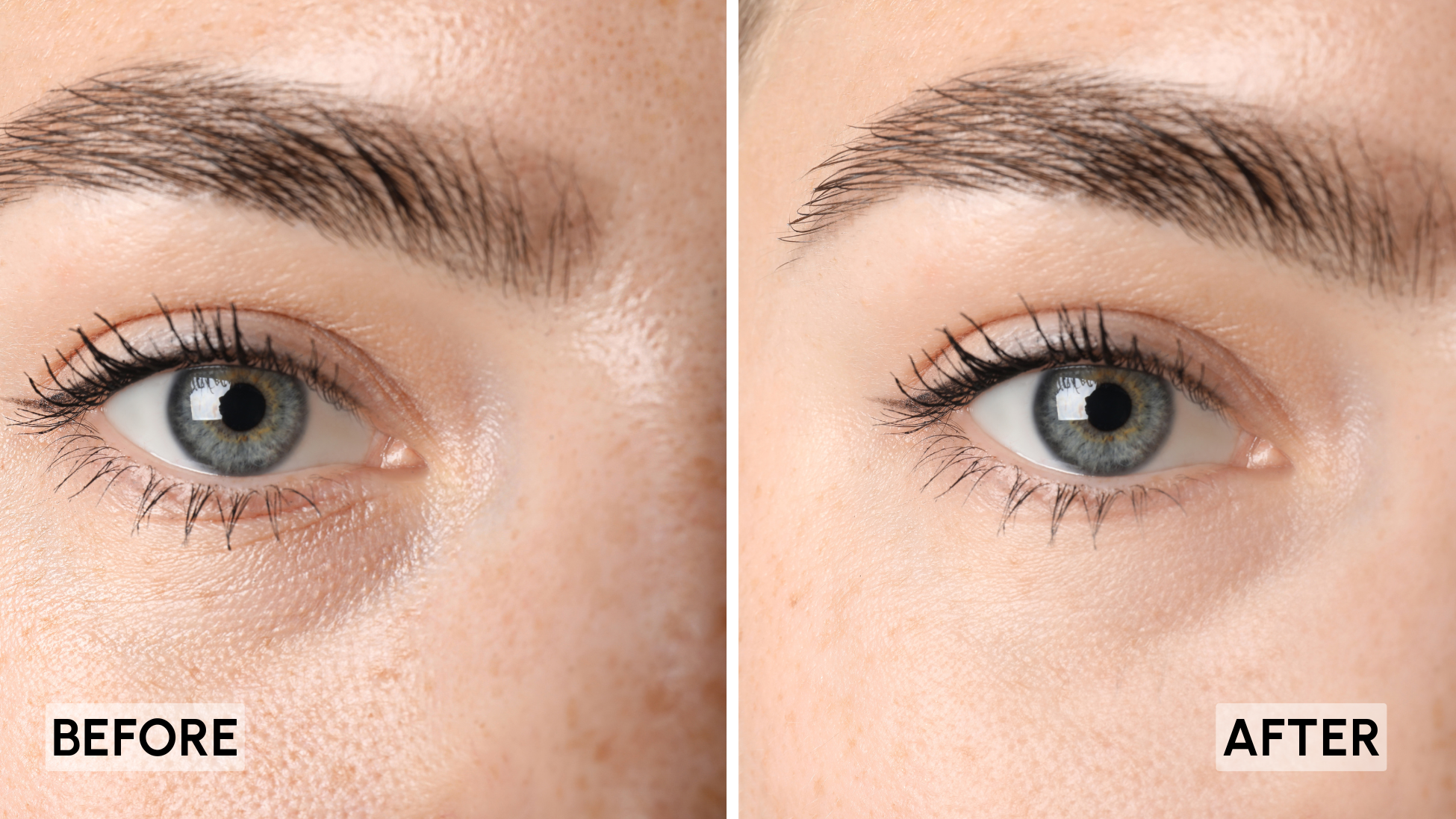 Before and after image showing uneven skin tone and dark patches around the eyes, with clearer and more even-looking skin after LED light mask use.